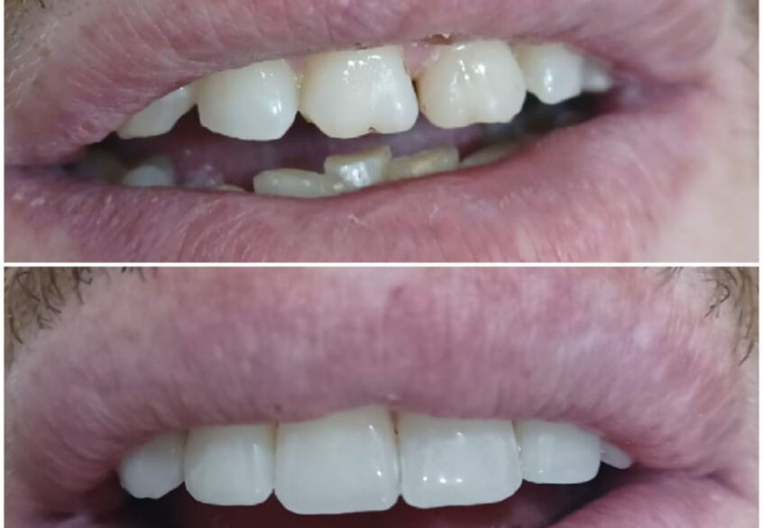 αισθητικές όψεις